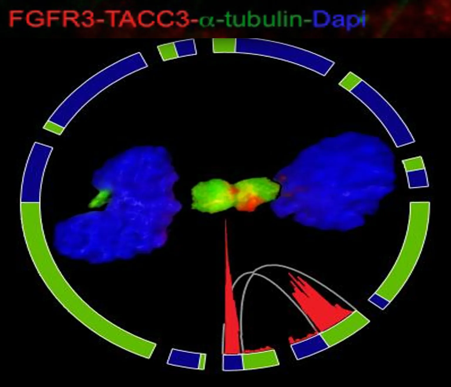 Transforming Fusions of FGFR and TACC Genes in Human Glioblastoma.
