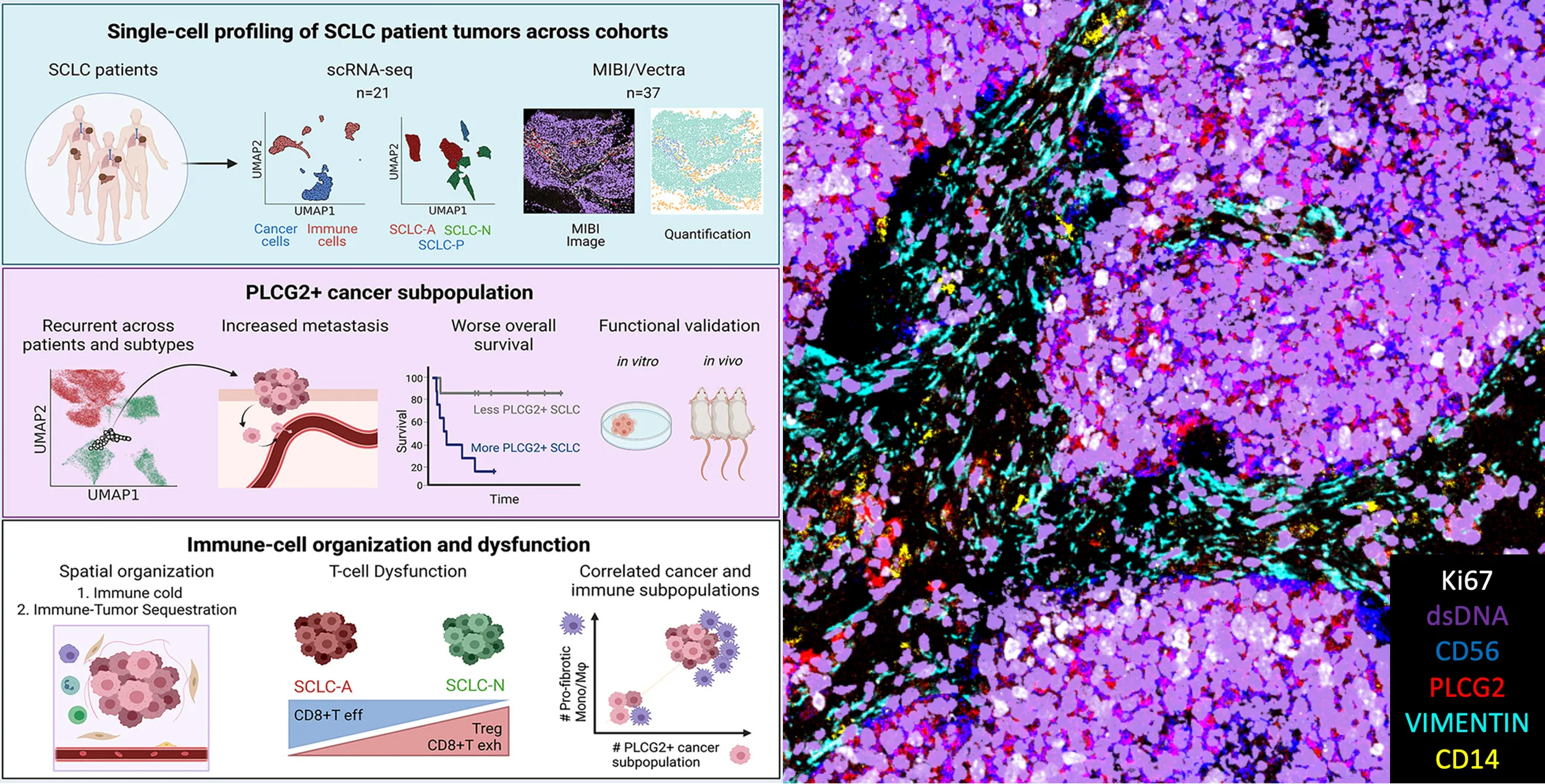 Signatures of plasticity, metastasis, and immunosuppression in an atlas of human small cell lung cancer.